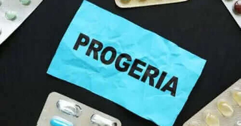 Resveratrol and progeria research hero image