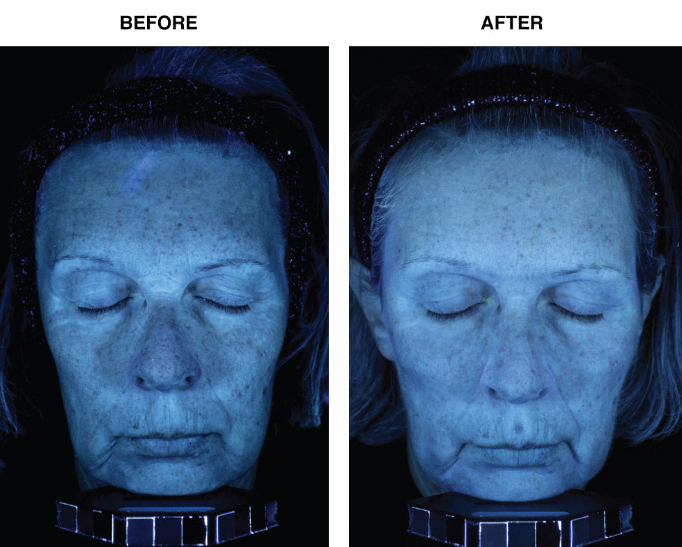 IDEO Skincare Skin Memory Serum - U.S. Patent No. 8,435,547 Before-After-Comps---2